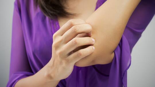 Natur pur gegen Juckattacken