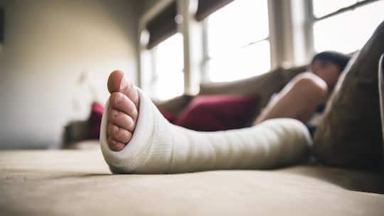 Kinderfuss im Gips - Nach einem Sturz pflegt eine Mutter ihren verletzten Sohn drei Monate lang zu Hause. Eine Entschädigung erhält sie dafür nicht. Wie der Anspruch auf Betreuungsurlaub für Eltern geregelt ist