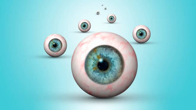 Wie sich Augenärzte durch die Operation bereichern Für spezielle Linsen gegen grauen Star verlangen Augenärzte ungerechtfertigt hohe Aufschläge. Illustration Augapfel eines menschlichen Auges.