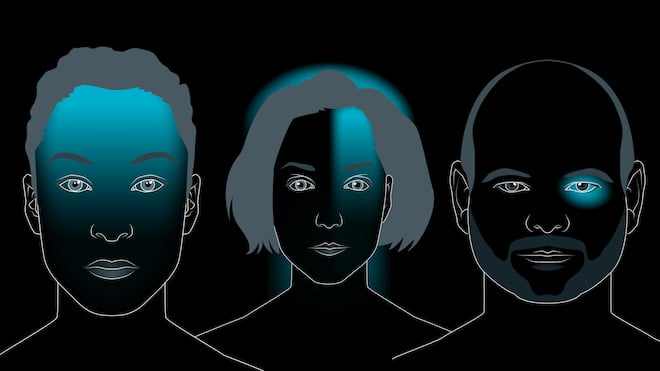 Wo und wie tut der Kopf weh? Unterschied der Schmerzorte bei Spannungskopfschmerzen, Migräne und Cluster-Kopfschmerzen