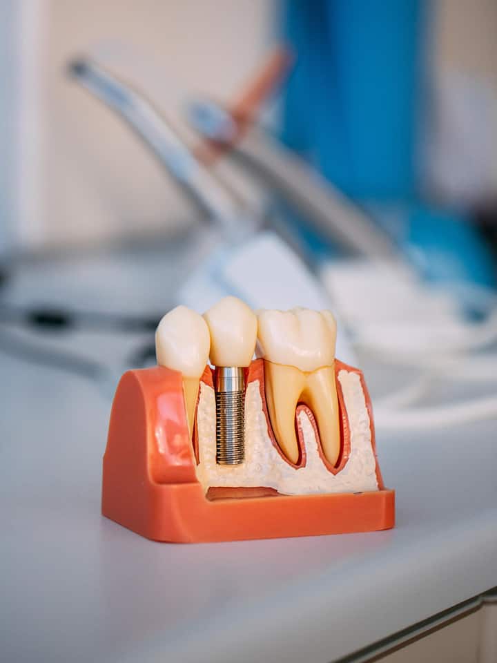 Teeth Model on Dentist's Office1288062288