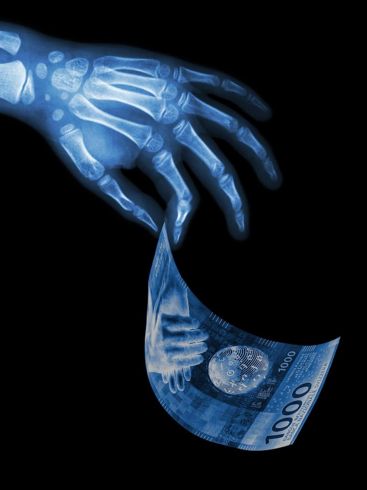 Radiologen können bei 3R ein Einkommen von einer halben Million Franken und mehr erzielen.