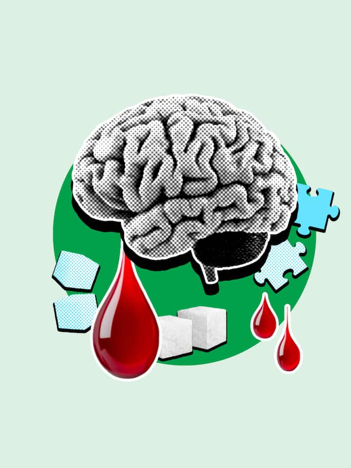 Collage mit Gehirn, Zucker und Blut - Ist die Demenzerkrankung wirklich eine Folge der Zuckerkrankheit? Was an dieser Behauptung dran ist – und wie man sein Gehirn fit hält