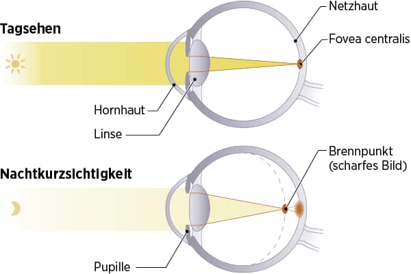 Infografik: Tagsehen vs. Nachtkurzsichtigkeit