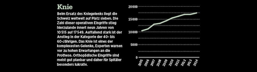 Grafische Darstellung der Anzahl Operationen am Knie