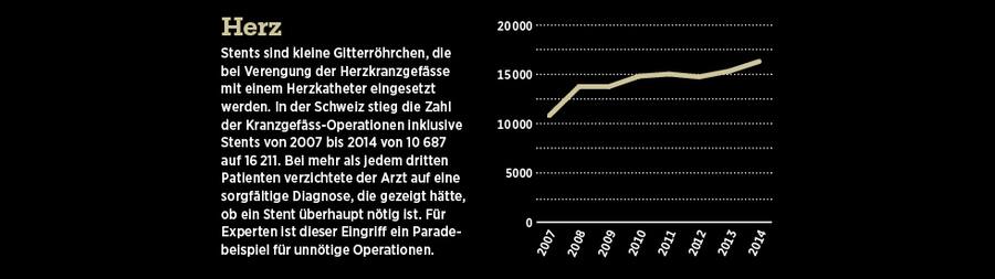 Grafische Darstellung der Anzahl Operationen am Herz.