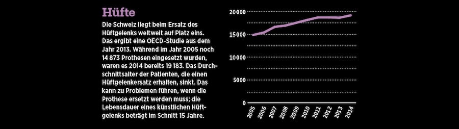 Grafische Darstellung der Anzahl Hüftgelenksoperationen