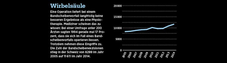 Grafische Darstellung der Anzahl Operationen an der Wirbelsäule.