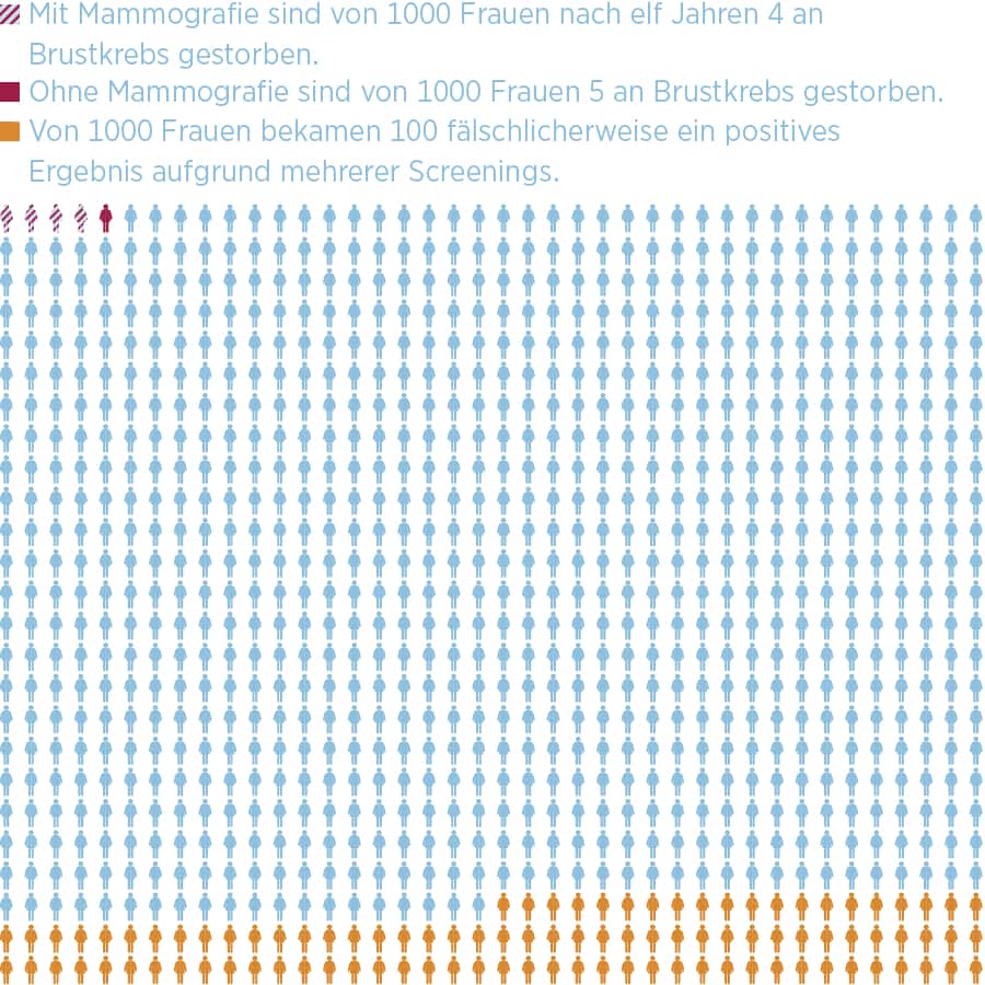 Mammografie-Screening: Die Fakten