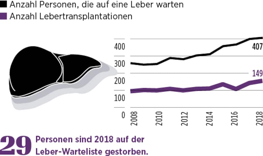 Grafische Darstellung der Anzahl Lebertransplantationen in der Schweiz.