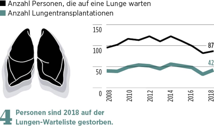 Grafische Darstellung, wie viele Lungen in der Schweiz transplantiert wurden.