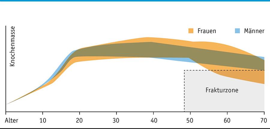 Die Grafik zeigt, wie sich die Knochenmasse im Laufe des Lebens verändert.