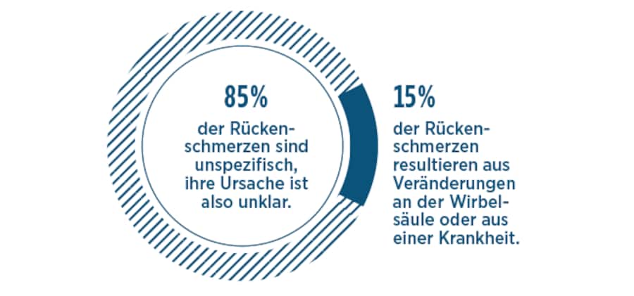 Grafische Darstellung, wie Rückenschmerzen zustande kommen.