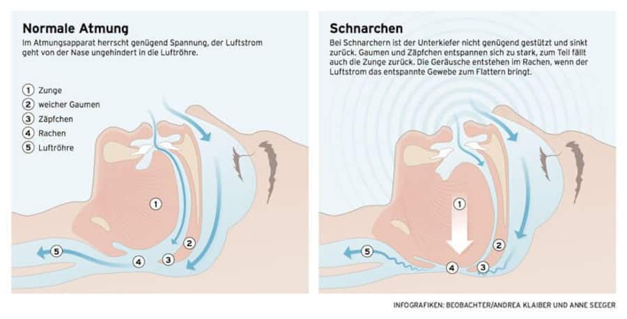 Infografik über Schnarchen
