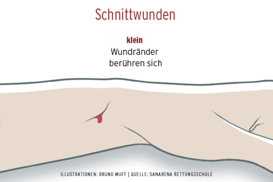 Schnittwunde versorgen