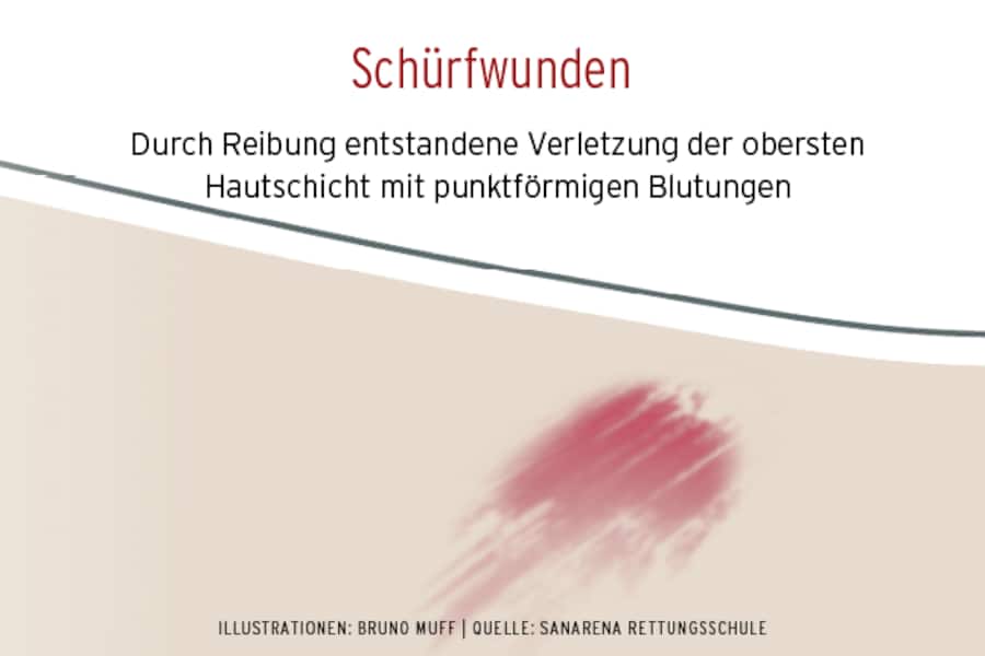 Schürfwunde