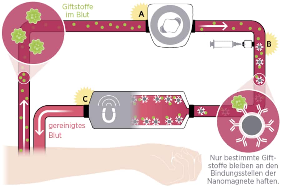 So funktioniert Hemotune