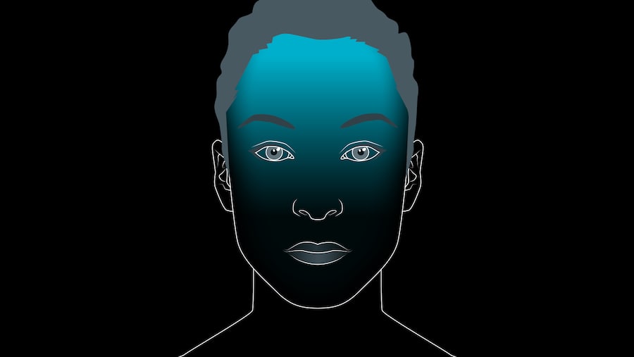 Schmerzort von Spannungskopfschmerzen