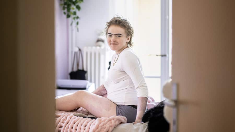 Portrait d’ Agata Strzelczak réalisé chez elle à Miège. Cette jeune fille de 16 ans à survécu à l’incendie du bar le constellation survenu à Crans Montana le 1er janvier 2026. Son corps à été brulé à 65%, six mois après, elle témoi…