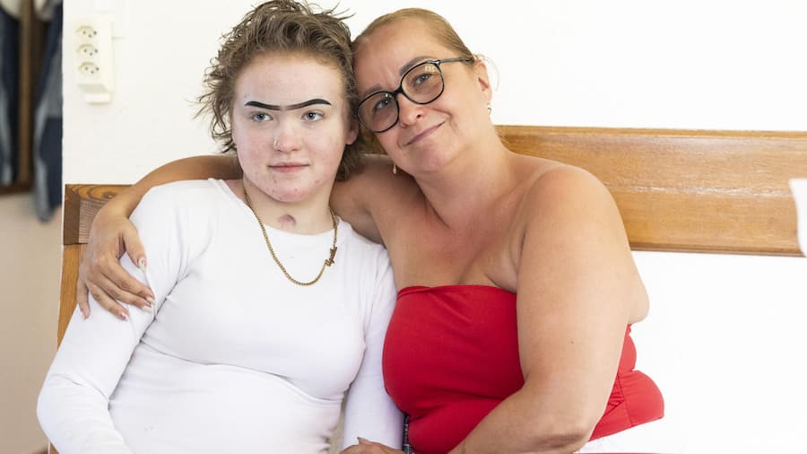 Portrait d’ Agata Strzelczak réalisé chez elle à Miège. Cette jeune fille de 16 ans à survécu à l’incendie du bar le constellation survenu à Crans Montana le 1er janvier 2026. Son corps à été brulé à 65%, six mois après, elle témoi…