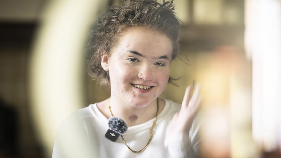 Portrait d’ Agata Strzelczak réalisé chez elle à Miège. Cette jeune fille de 16 ans à survécu à l’incendie du bar le constellation survenu à Crans Montana le 1er janvier 2026. Son corps à été brulé à 65%, six mois après, elle témoi…